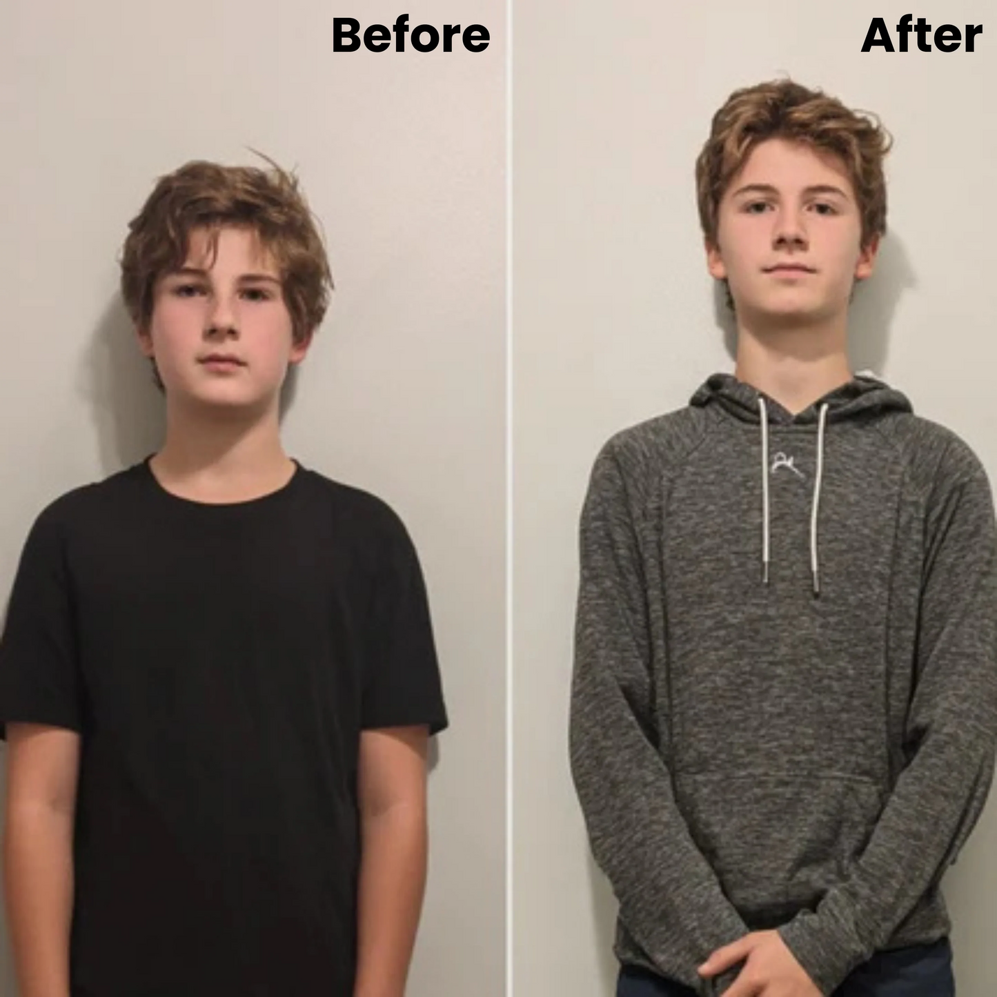 Voleria™ Heightener Overnight Growth Gummies